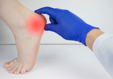 heel-pain